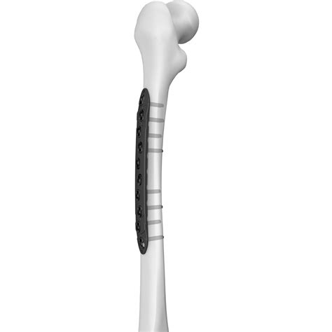 Compression Take Off Plate 的图像结果