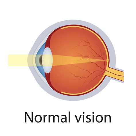 Image result for Normal Human Eye