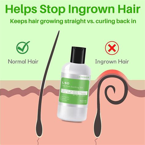 LAVO Tea Tree Gel with Salicylic Acid - Ultimate Ingrown Hair Treatment for Men and Women ...