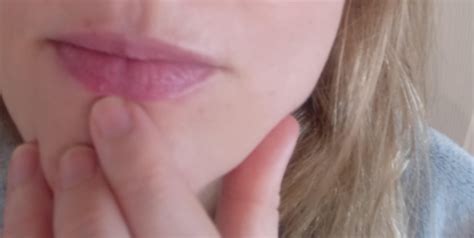 Small painless bump on lip : r/DermatologyQuestions