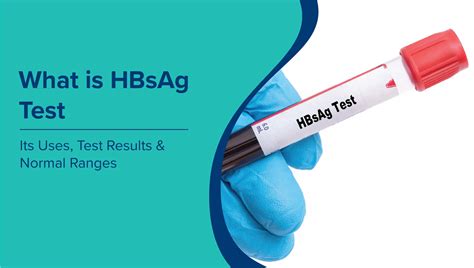 What is HBsAg Test: Purpose, Normal Range, Results & Prevention | MaxAtHome
