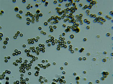 Yeast Fungi Organisms Under Microscope 100x Stock Footage