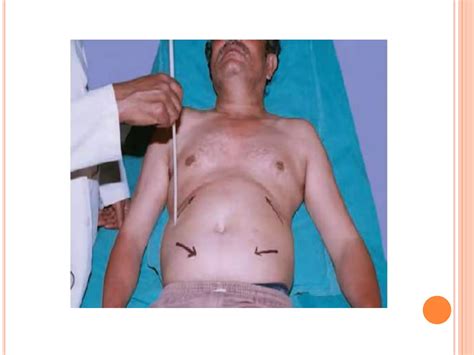 Reflexes - Superficial and Deep tendon reflexes | PPTX