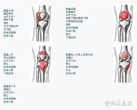 [分享]膝盖劳损的治疗方法及预防_单车机车_资阳大众网论坛