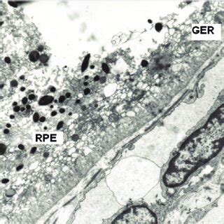 Image result for RPE Hexagonal Structure