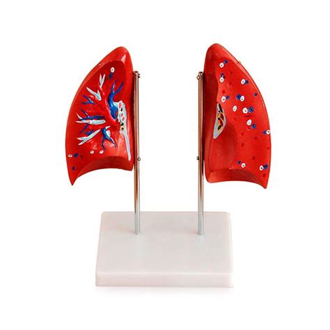 Modelo de Pulmón - Suizmed