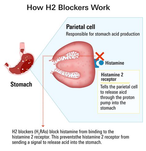 Apprentices anyone voting GIH by hers cabinet software might can ...