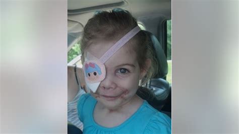 Fake? Story of girl getting kicked out of KFC because of scars ...