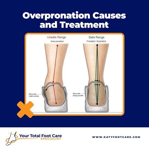 Overpronation Causes & treatment | Your Total Foot Care Specialist