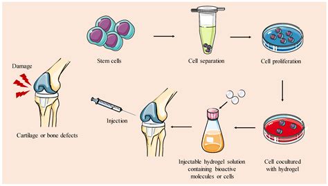 Advanced Hydrogel-Based Strategies for Enhanced Bone and Cartilage ...