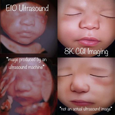 Minnesota's Best 3D Ultrasounds | Enlightened 4D Imaging