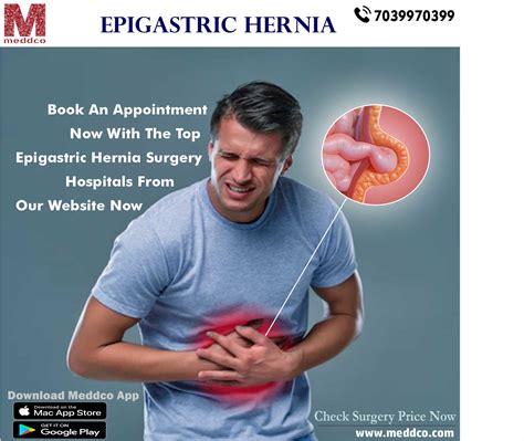 Epigastric Hernia - Symptoms, Causes, Treatment