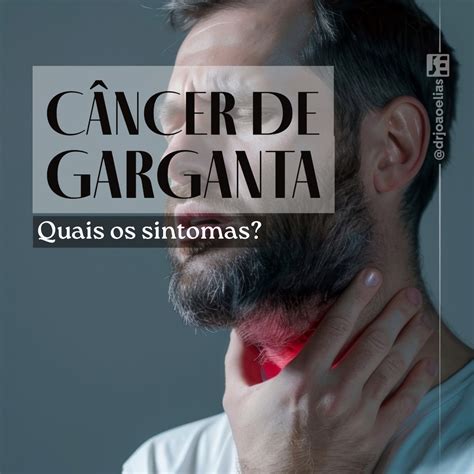 Quais os Sintomas do Câncer de Garganta? Os 8 principais! | Dr João Elias