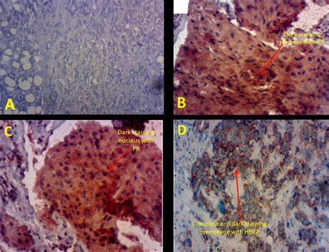Image result for Poor IHC Staining