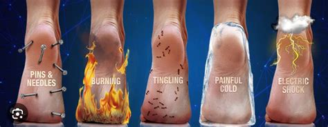 End Nerve Pain caused by Neuropathy, 139 S Main St, London, OH, United ...