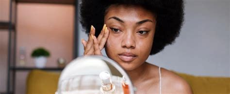 How to Remove Sun Spots on Face – Abera.us