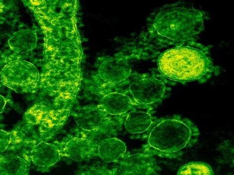 Study finds immune therapy targets cells that cause leukemia relapse