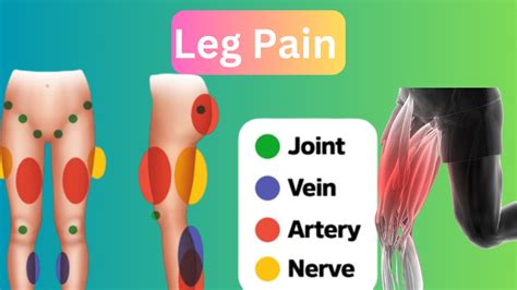 Leg Pain View: Causes, Types, Symptoms & Best Treatment