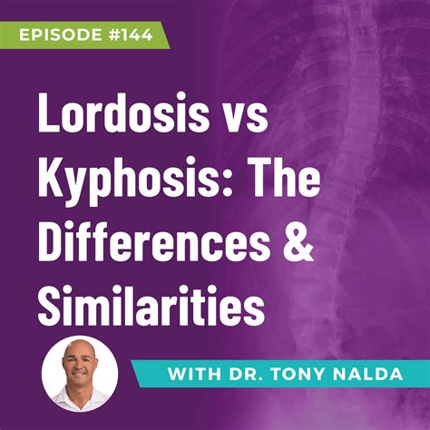Episode 144: Lordosis vs Kyphosis: The Differences & Similarities