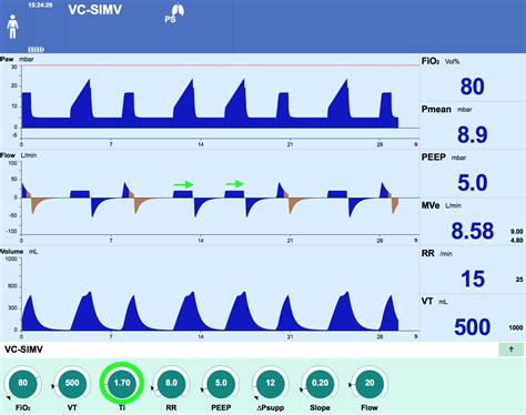 Ventilation Modes - Neuroresus