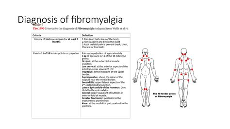 fibromyalgia versus myofascial pain syndrome mps trigger points .pptx