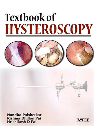 Textbook of Hysteroscopy eBook : Nandita, Palshetkar: Amazon.in: Kindle ...