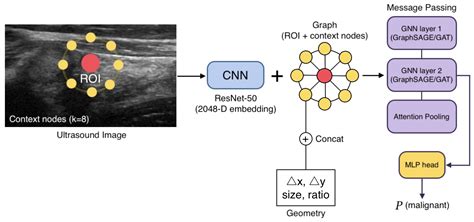 ROI+Context Graph Neural Networks for Thyroid Nodule Classification ...