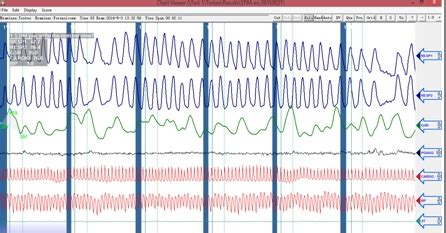 Computerized Polygraph 的图像结果