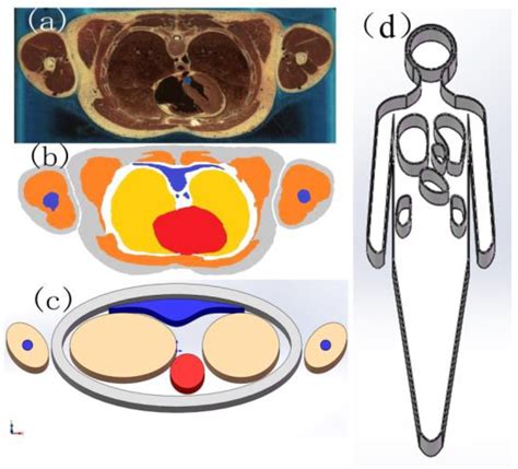 Research on an Anthropomorphic Phantom for Evaluation of the Medical ...