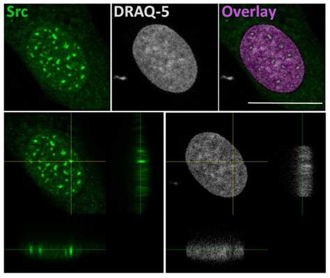 Nuclear Functions of the Tyrosine Kinase Src