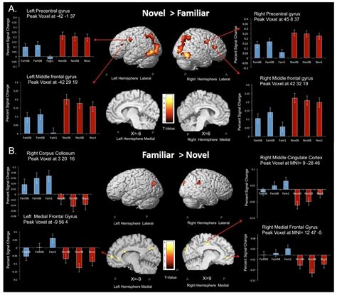 Common and Distinct Functional Brain Networks for Intuitive and ...