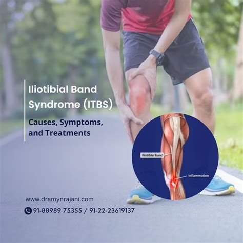 Iliotibial Band Syndrome Treatment