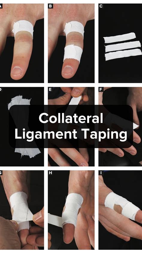 Collateral Ligament Injury Finger Male Patient 43 Years Old,