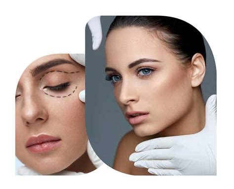 Scar Revision Procedure 的图像结果