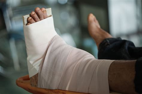 The Pros and Cons of Ankle Fusion Surgery