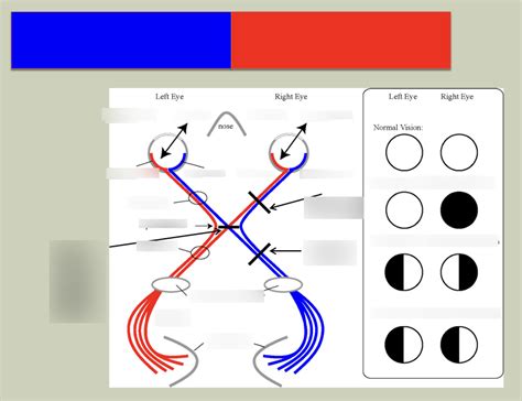 Image result for Visual Deficit Chart