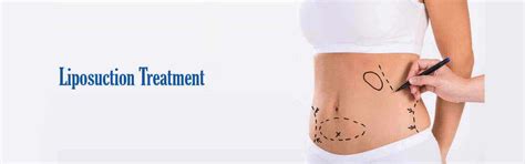 Liposuction Treatment In Botswana, Liposuction Treatment Hospital Botswana