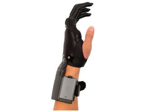 Best Prosthetic Fingers & Hands | Improve Your Grip with KARE