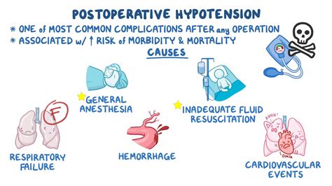 Thymectomy Post Op Complications at Laurie Hamlett blog