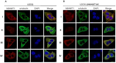 Cross-Reactivity of N6AMT1 Antibodies with Aurora Kinase A: An Example ...