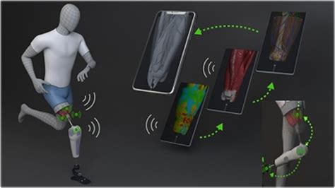 Image result for Bionic Arm Prosthetics