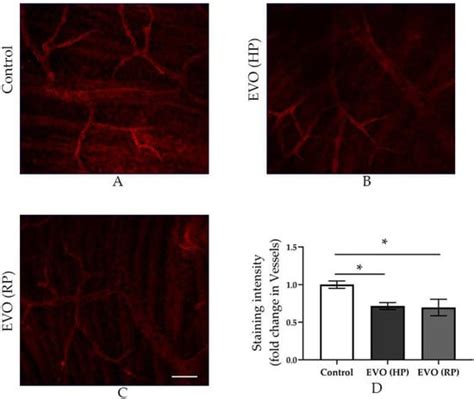 Intraocular Pressure-Induced Endothelial Dysfunction of Retinal Blood ...