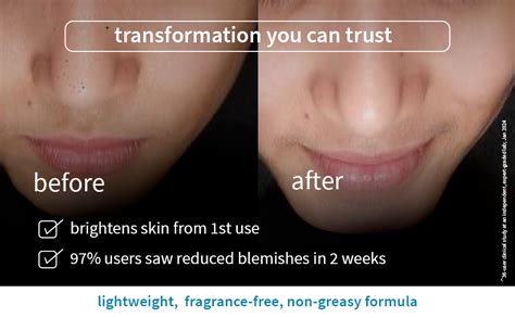 Plum 10% Niacinamide Serum with Rice Water | Provides Clear, Glowing ...