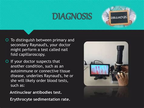 Nursing management Of patients with Raynaud's disease | PPTX