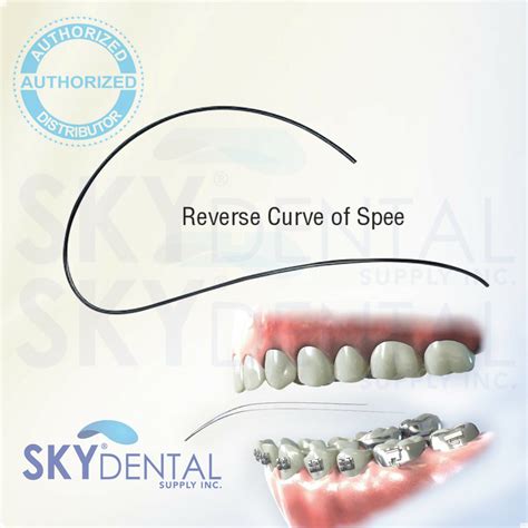 NiTi Wires RCS Reverse Curve of Spee Dental Rectangular Archwire 10/pk ...