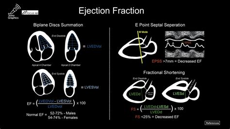 POCUS-Ultrasound Pocket Cards - POCUS 101