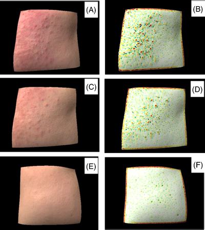 Image result for Skin Tissue Texture Mapping