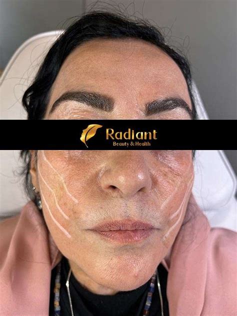 Image result for Face Threads