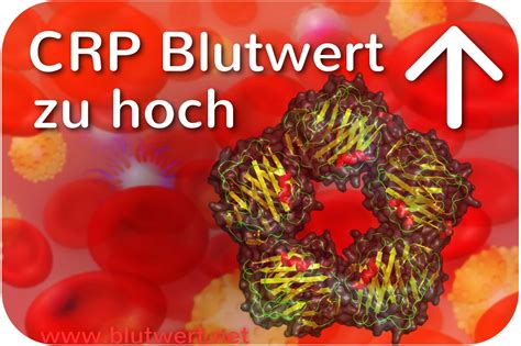 Resultado de imagen de isolierter crp anstieg