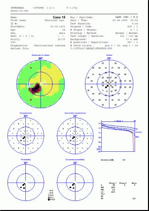 Image result for Visual Fields Red Pin